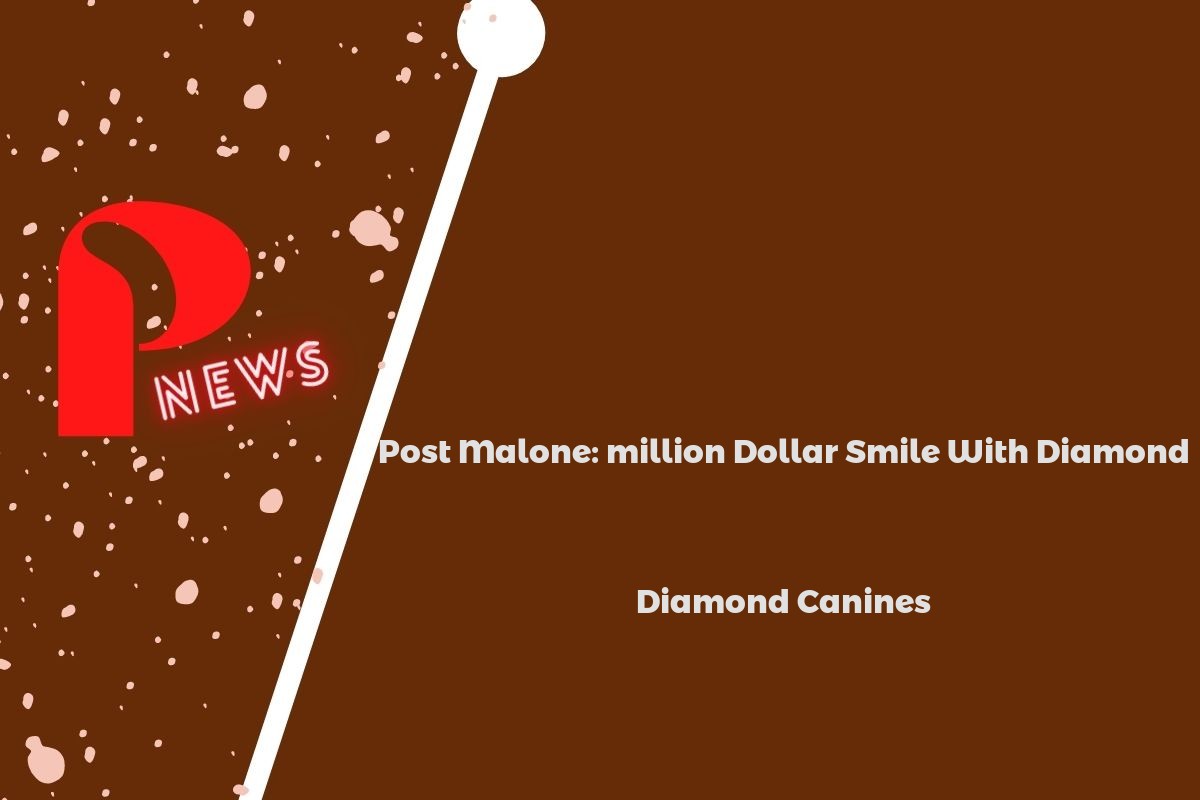 Post Malone: million Dollar Smile With Diamond Canines