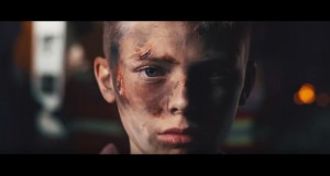 Kati Me Pligonei Music Video