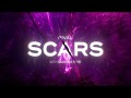 Scars