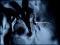 Anesthesia
