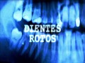 Dientes Rotos